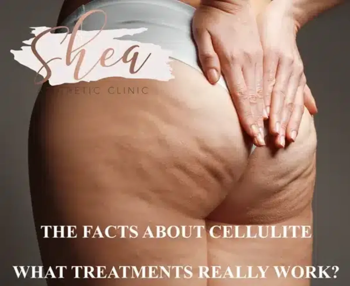 Cellulite treatment Qwo gets rid of cellulite with injection
