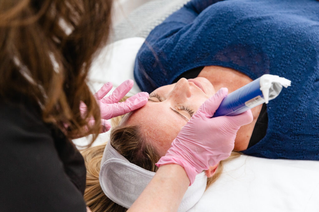 One of our estheticians in Oak Ridge glides a microneedling pen across your skin.