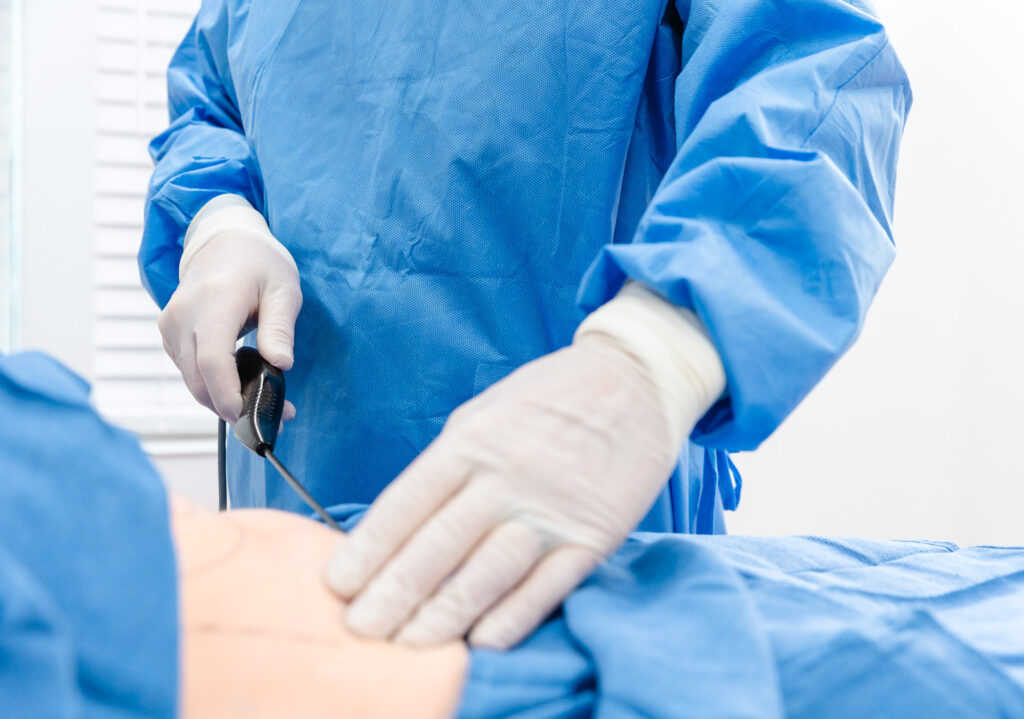 Dr. Bass's hands, in surgical gloves, using the Quantum RF wand as part of a treatment plan for liposuction near Knoxville.