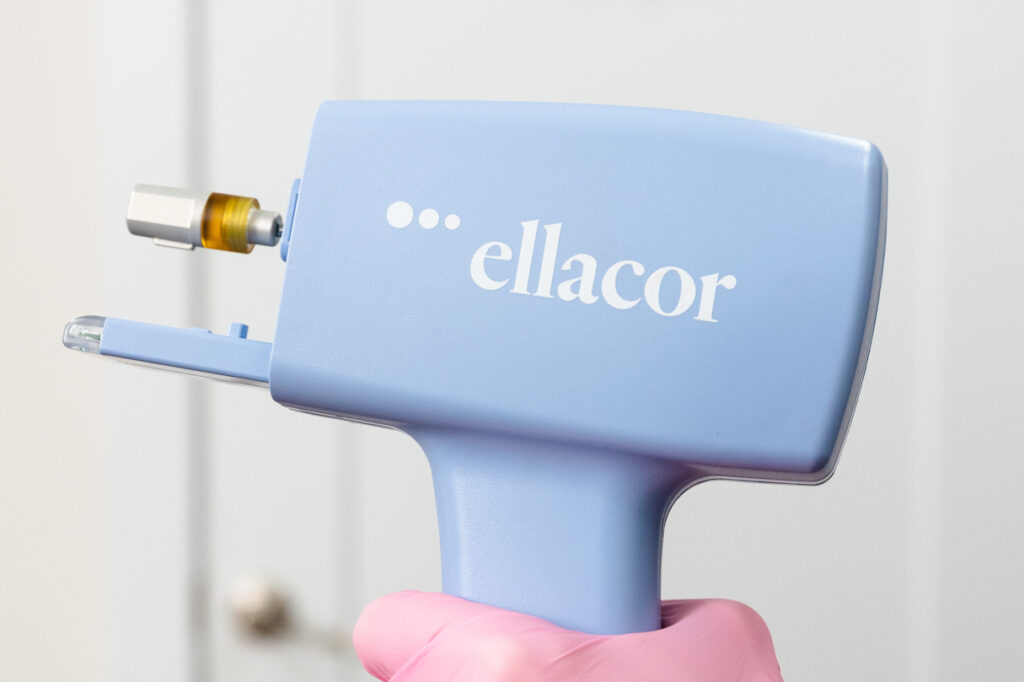 Dr. Bass holds up a device for skin tightening, otherwise known as Ellacor near Knoxville.